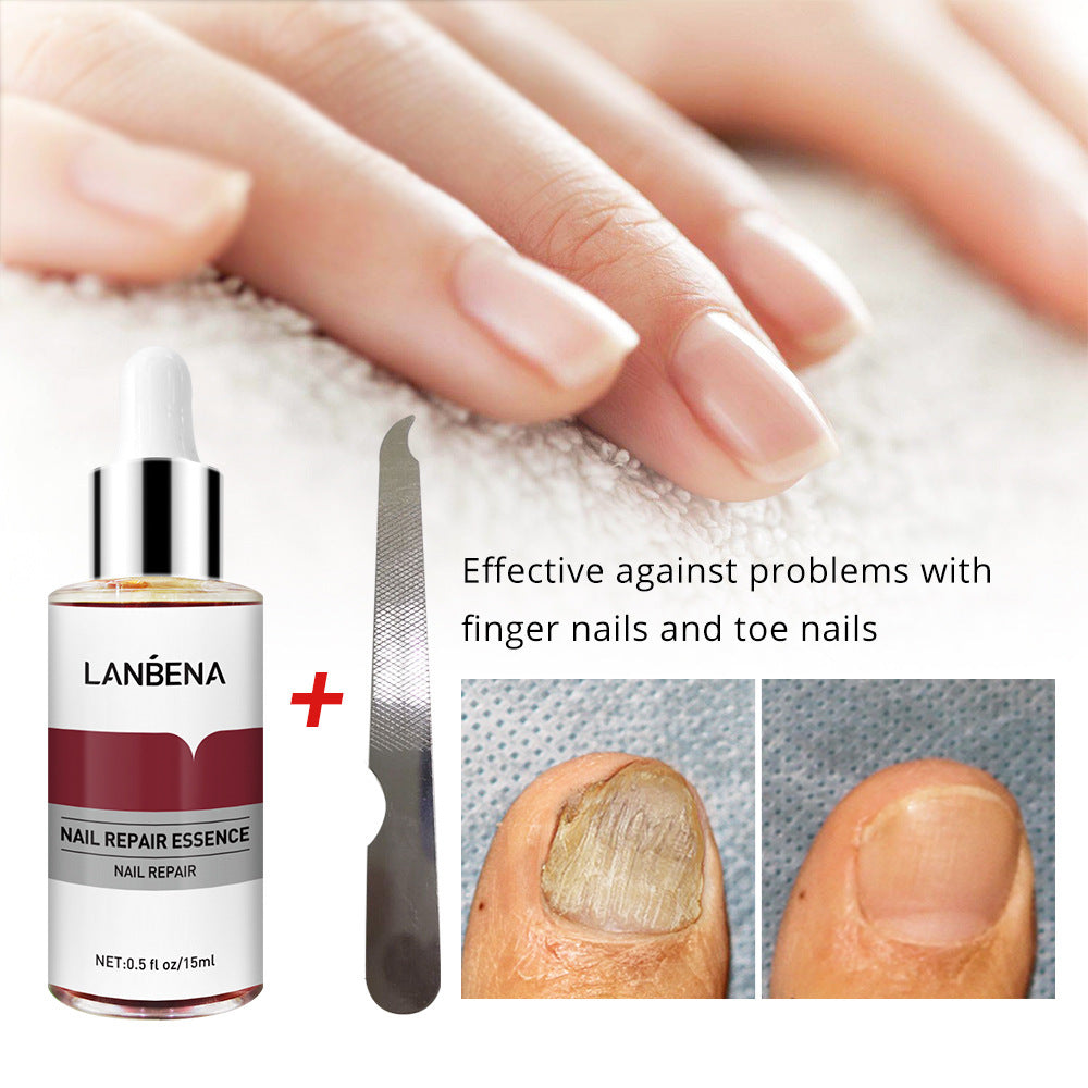 Nail Repair With Small File 15ml Anti-Onychomycosis Foot